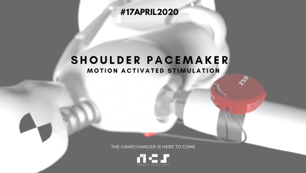 From standard electrostimulation to Motion Activated Stimulation ...